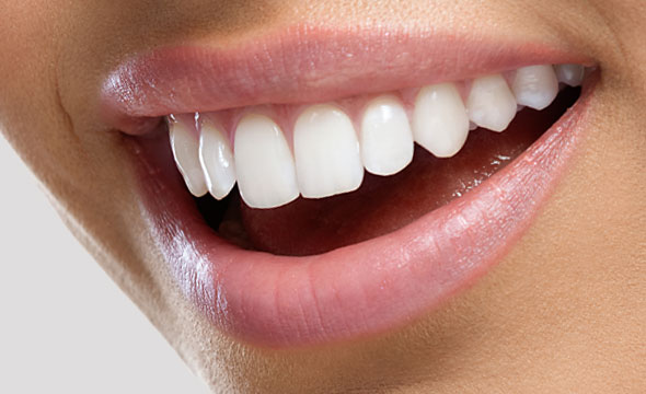 Professioneller Einsatz von Veneers bei der Zahnarztpraxis Zahnerhaltung Schneid & Schneid in Augsburg